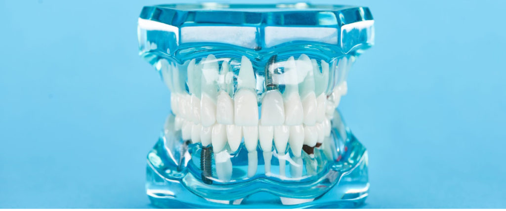 Dental Marketing